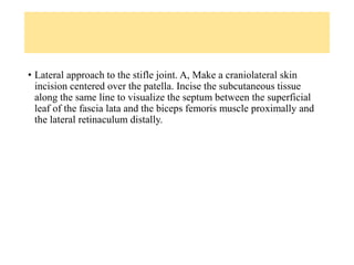 • Lateral approach to the stifle joint. A, Make a craniolateral skin
incision centered over the patella. Incise the subcutaneous tissue
along the same line to visualize the septum between the superficial
leaf of the fascia lata and the biceps femoris muscle proximally and
the lateral retinaculum distally.
 