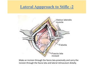 Lateral Appproach to Stifle -2
Make an incision through the fascia lata proximally and carry the
incision through the fascia lata and lateral retinaculum distally.
 
