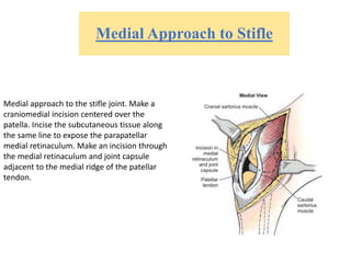 Medial Approach to Stifle
Medial approach to the stifle joint. Make a
craniomedial incision centered over the
patella. Incise the subcutaneous tissue along
the same line to expose the parapatellar
medial retinaculum. Make an incision through
the medial retinaculum and joint capsule
adjacent to the medial ridge of the patellar
tendon.
 