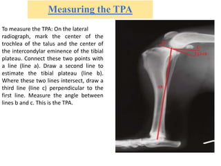 Measuring the TPA
To measure the TPA: On the lateral
radiograph, mark the center of the
trochlea of the talus and the center of
the intercondylar eminence of the tibial
plateau. Connect these two points with
a line (line a). Draw a second line to
estimate the tibial plateau (line b).
Where these two lines intersect, draw a
third line (line c) perpendicular to the
first line. Measure the angle between
lines b and c. This is the TPA.
 