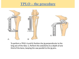 TPLO – the procedure
To perform a TPLO: A and B, Position the jig perpendicular to the
long axis of the tibia. C, Perform the osteotomy to a depth of one
third of the bone, keeping the saw parallel to the jig pins.
 
