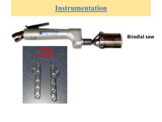 Instrumentation
Biradial saw
 
