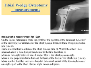 Tibial Wedge Osteotomy
– measurements
Radiographic measurement for TWO.
On the lateral radiograph, mark the center of the trochlea of the talus and the center
of the intercondylar eminence of the tibial plateau. Connect these two points with a
line (line a).
Draw a second line to estimate the tibial plateau (line b). Where these two lines
intersect, draw a third line perpendicular to the first line (line c).
Measure the angle between lines b and c. This is the tibial plateau angle.
Make a line perpendicular to line a at the base of the flare of the tibial crest (line d).
Make another line that intersects line d at the caudal aspect of the tibia and creates
an angle equal to the tibial plateau angle minus 6 degrees.
 