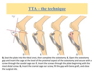 TTA – the technique
D, Seat the plate into the tibial crest, then complete the osteotomy. E, Open the osteotomy
gap and insert the cage at the level of the proximal aspect of the osteotomy and secure with a
screw through the caudal cage ear. F, Insert the screws through the plate beginning with the
most distal screw. G, Insert the cranial cage ear screw, fill the gap with bone graft, and close
the surgical site.
 