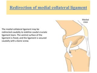 Redirection of medial collateral ligament
The medial collateral ligament may be
redirected caudally to stabilize caudal cruciate
ligament tears. The ventral surface of the
ligament is freed, and the ligament is secured
caudally with a bone screw.
 
