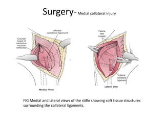 Surgery-Medial collateral injury
FIG Medial and lateral views of the stifle showing soft tissue structures
surrounding the collateral ligaments.
 