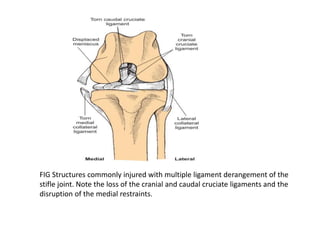 FIG Structures commonly injured with multiple ligament derangement of the
stifle joint. Note the loss of the cranial and caudal cruciate ligaments and the
disruption of the medial restraints.
 