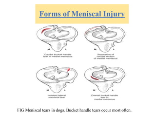 Forms of Meniscal Injury
FIG Meniscal tears in dogs. Bucket handle tears occur most often.
 
