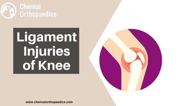 Ligament injuries of knee | PDF