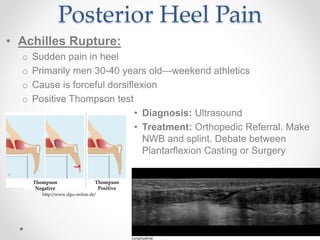 Ligament injury around ankle.pptx