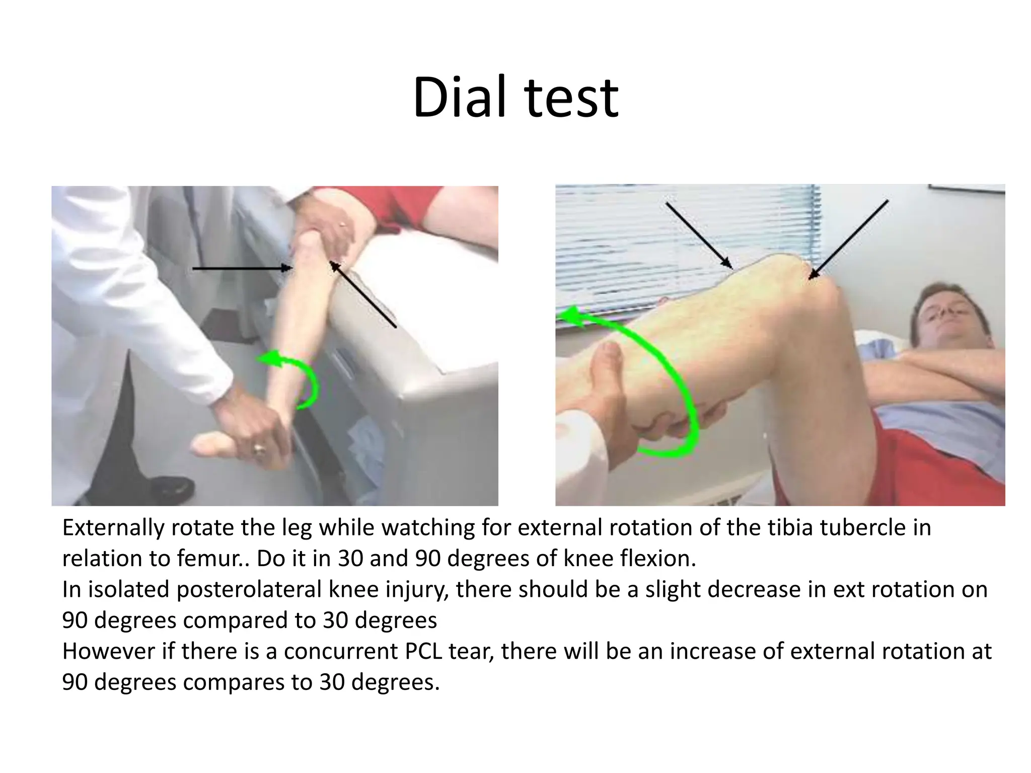 Dial Test ligament injury of the Lower extremities | PPTX