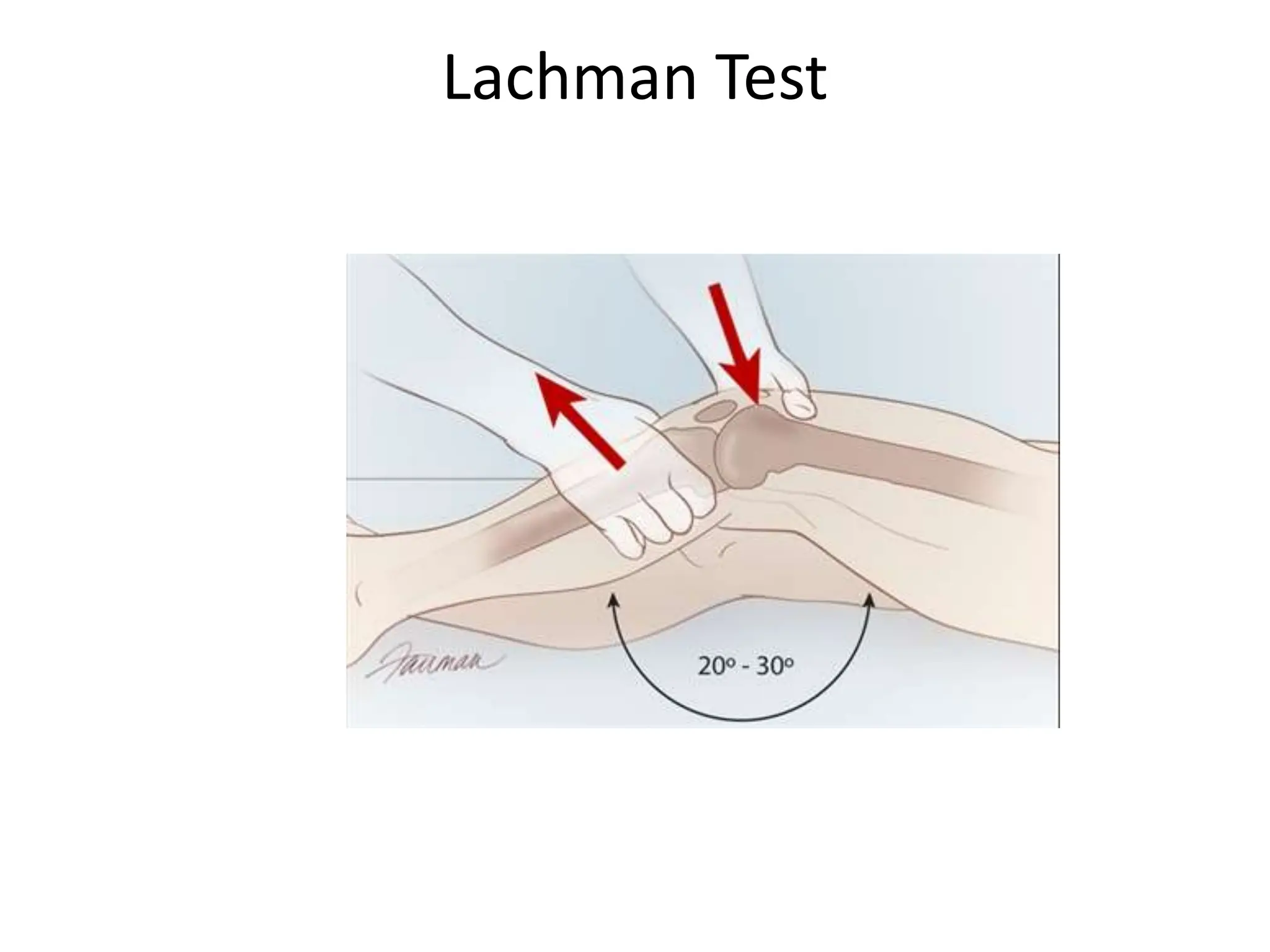 ligament injury of the Lower extremities | PPTX