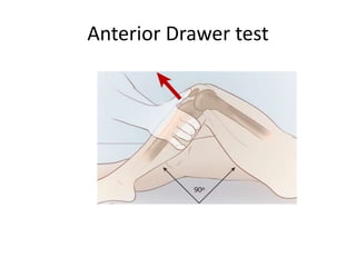ligament injury of the Lower extremities | PPTX