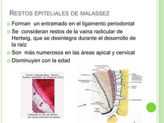 RESTOS EPITELIALES DE MALASSEZ
 Forman un entramado en el ligamento periodontal
 Se consideran restos de la vaina radicular de
Hertwig, que se desintegra durante el desarrollo de
la raíz
 Son más numerosos en las áreas apical y cervical
 Disminuyen con la edad
 