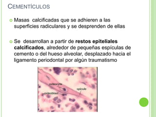 CEMENTÍCULOS
 Masas calcificadas que se adhieren a las
superficies radiculares y se desprenden de ellas
 Se desarrollan a partir de restos epiteliales
calcificados, alrededor de pequeñas espículas de
cemento o del hueso alveolar, desplazado hacia el
ligamento periodontal por algún traumatismo
 