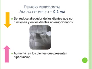 ESPACIO PERIODONTAL
ANCHO PROMEDIO = 0.2 MM
 Se reduce alrededor de los dientes que no
funcionan y en los dientes no erupcionados
 Aumenta en los dientes que presentan
hiperfunción.
 