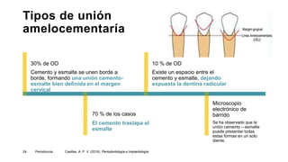 Tipos de unión
amelocementaría
Cemento y esmalte se unen borde a
borde, formando una unión cemento-
esmalte bien definida en el margen
cervical
30% de OD
El cemento traslapa el
esmalte
70 % de los casos
Se ha observado que la
unión cemento – esmalte
puede presentar todas
estas formas en un solo
diente.
Microscopio
electrónico de
barrido
Existe un espacio entre el
cemento y esmalte, dejando
expuesta la dentina radicular
10 % de OD
Periodoncia
24 Casillas, A. P. V. (2016). Periodontología e Implantología.
 