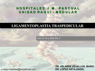 HOSPITALES J.M. PASCUAL
             UNIDAD RAQUI - MEDULAR



        LIGAMENTOPLASTIA TRASPEDICULAR


                                SISTEMA PHEBUS




                                          DR. VELARDE ZEVALLOS, MARIO
u.raqui-medular@jmpascual.com             DR. LÓPEZ ORTA,ÁNGEL
 