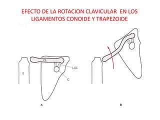 EFECTO DE LA ROTACION CLAVICULAR EN LOS
   LIGAMENTOS CONOIDE Y TRAPEZOIDE
 