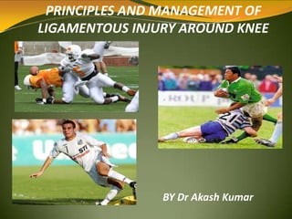 PRINCIPLES AND MANAGEMENT OF
LIGAMENTOUS INJURY AROUND KNEE
BY Dr Akash Kumar
 