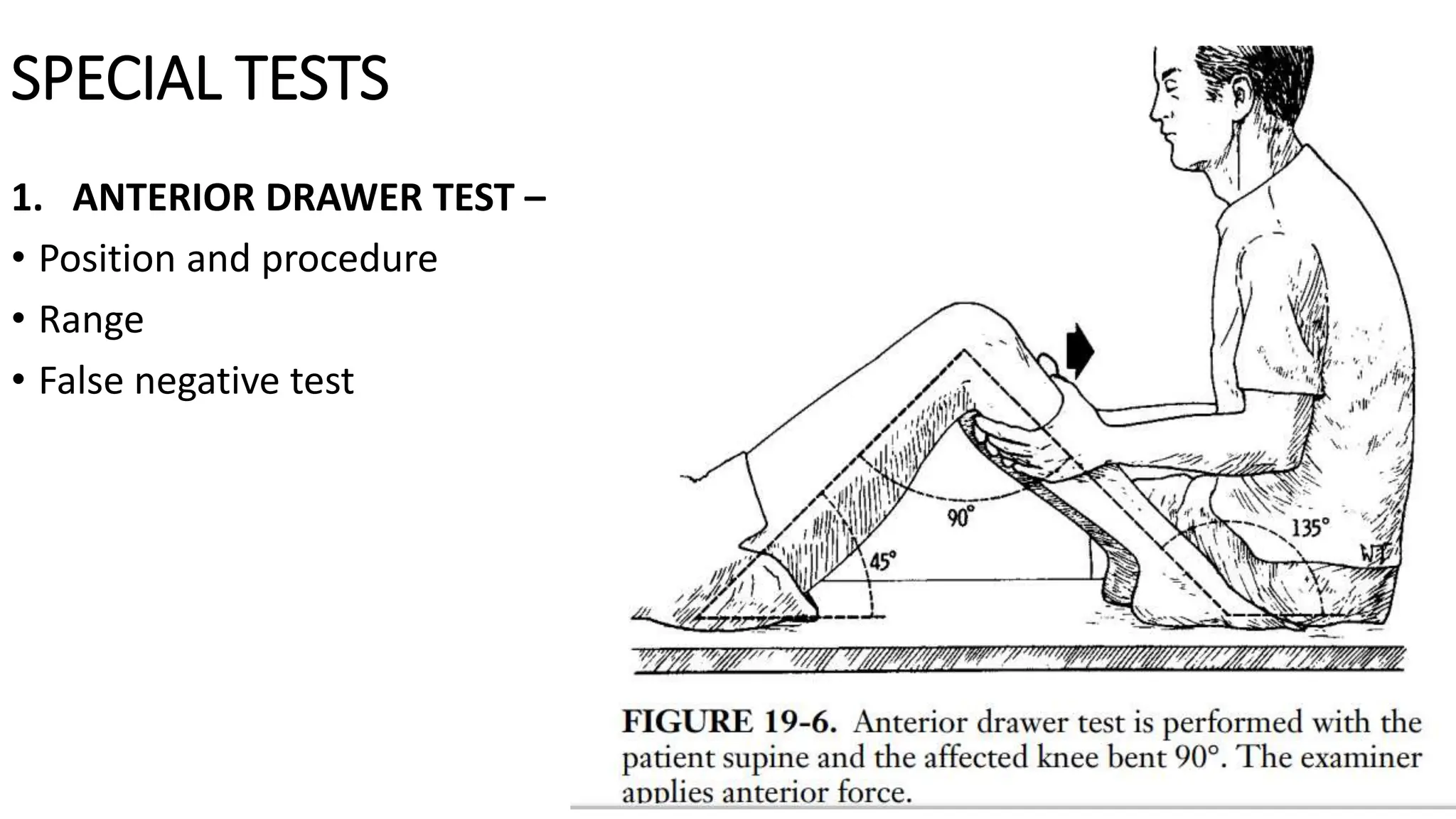 LIGAMENTS INJURIES AROUND KNEE.pptx