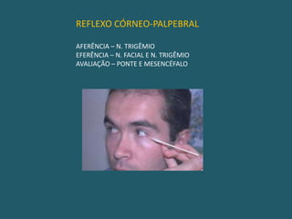 REFLEXO FOTOMOTOR                                                           AFERÊNCIA – N. ÓPTICO                                                           EFERÊNCIA – N. OCULOMOTOR                                                           AVALIAÇÃO – MESENCÉFALO 
