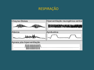 REFLEXO CÍLIO-ESPINHALEstimulação dolorosa na face ou trapézio produz midríase bilateral.Via aferente: ramo sensitivo do V par e de C1C2.Estimula N. espinhal, V par (bulbo) e ponta posterior medula cervical alta.Via eferente: feixe simpático central (n. simpático hipotalâmico) ->sinapse neurônios ponta lateral do H medular cervical ->gânglios simpáticos cervicais ->pupilas ->midríase.* AVALIA A INTEGRIDADE DAS FIBRAS SIMPÁTICAS