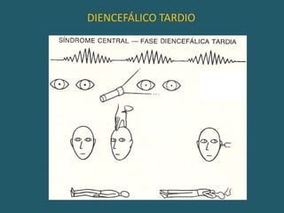 DIENCEFÁLICO INICIAL