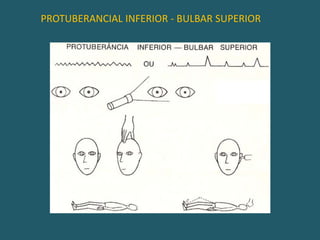 PROTUBERANCIAL SUPERIOR