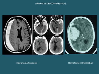Fazer rastreamento laboratorial.              EXAMES COMPLEMENTARESDIAGNÓSTICO LABORATORIAL:Sangue: gasometria arterial; hemograma; glicose, uréia, creatinina; TGO, TGP, fosfatase alcalina, Gama GT; Na, K, Mg, Ca, P.Perfil Toxicológico: Sangue e urina.TC ou RM, AGCLÍQUOREEG.
