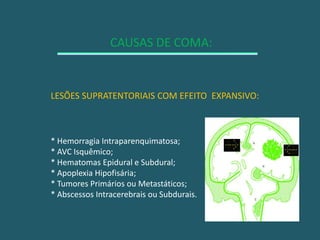 CAUSAS DE COMA:LESÕES SUPRATENTORIAIS COM EFEITO  EXPANSIVO:* Hemorragia Intraparenquimatosa;* AVC Isquêmico;* Hematomas Epidural e Subdural;* Apoplexia Hipofisária;* Tumores Primários ou Metastáticos;* Abscessos Intracerebrais ou Subdurais.