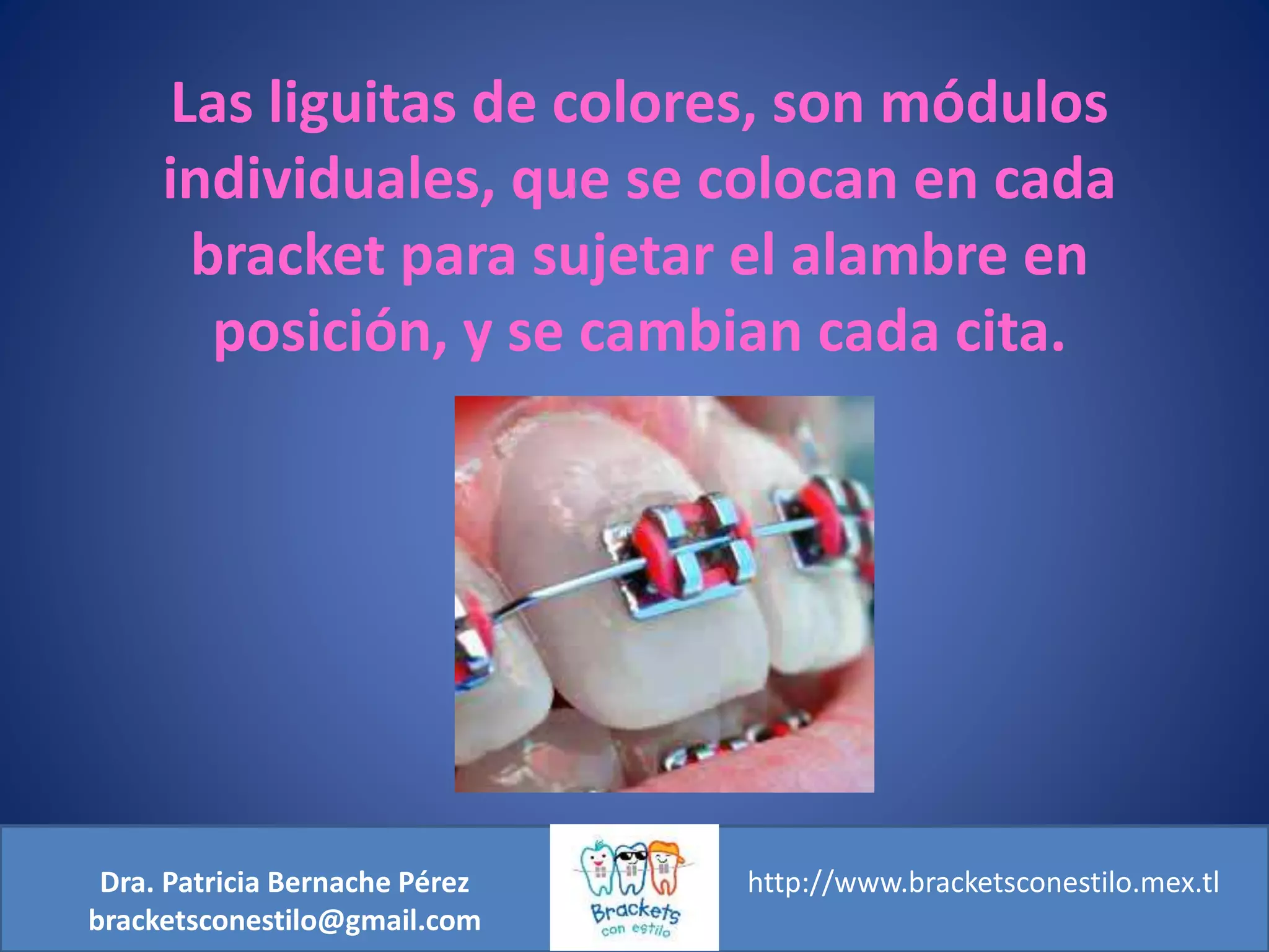 ¿Son Brackets de colores o son ligas de colores? PPT
