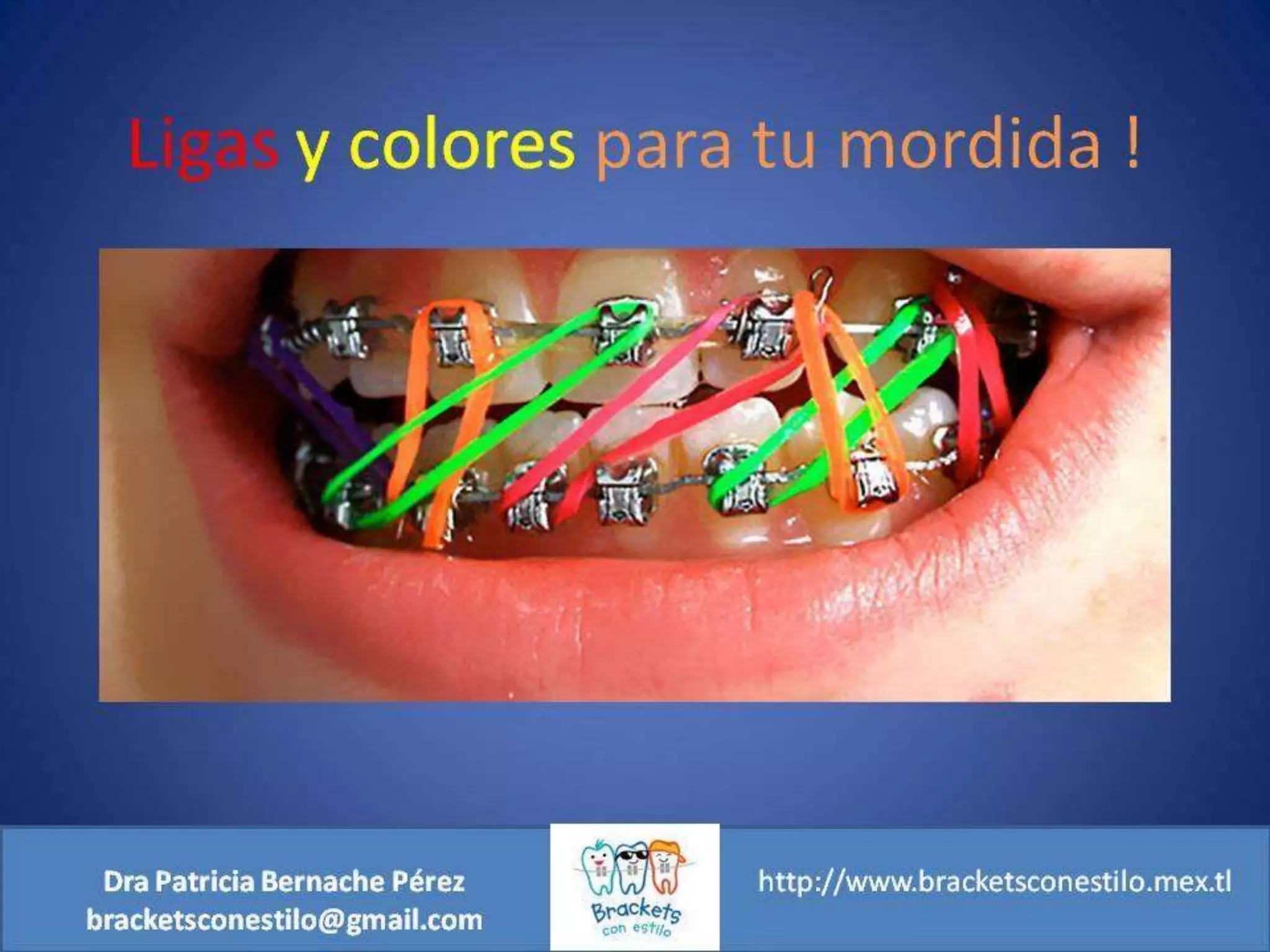 ¿Son Brackets de colores o son ligas de colores? PPT