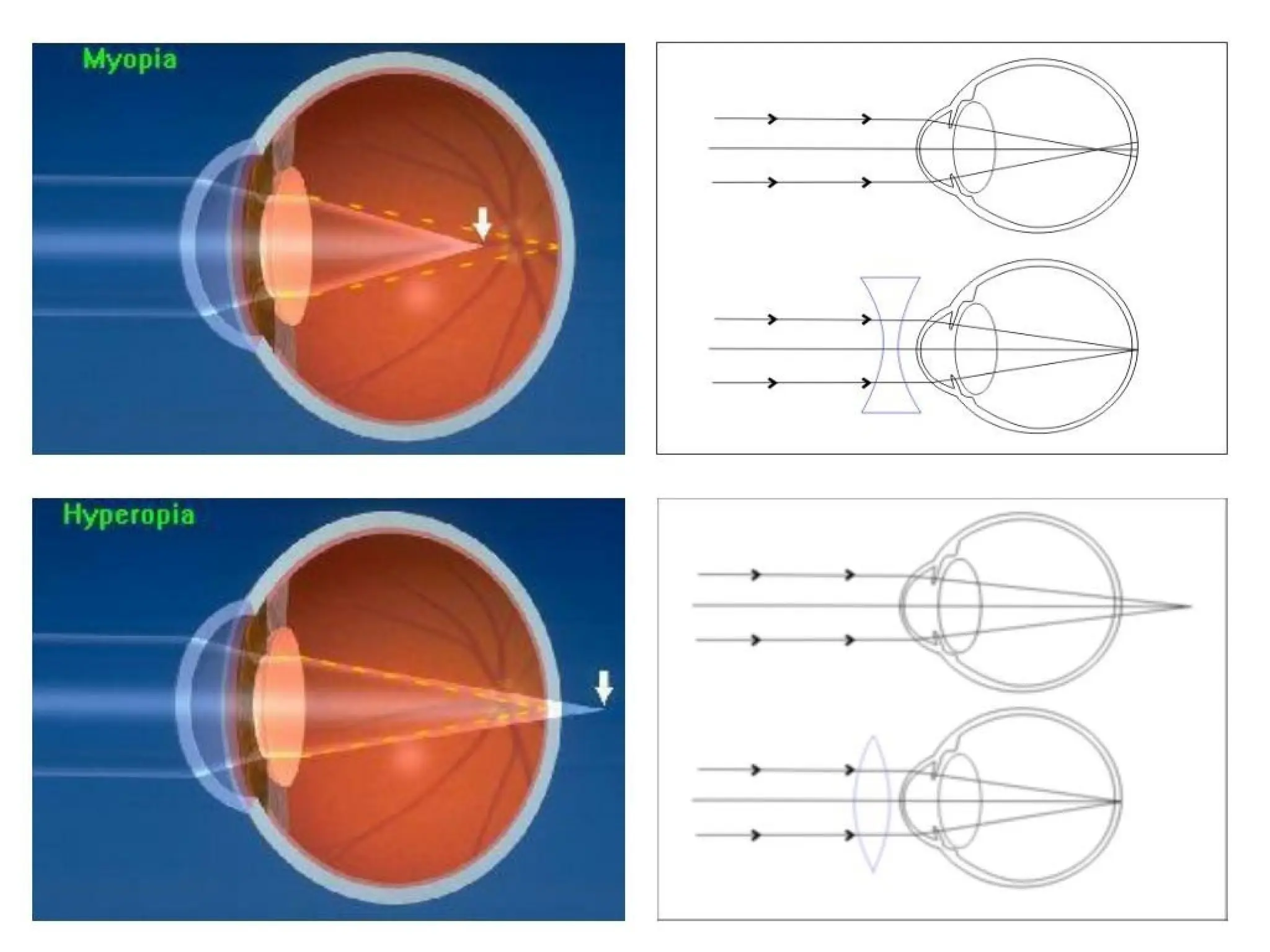 class 8 teaching ppt for chapter light .pptx