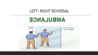 LEFT- RIGHT REVERSAL
 