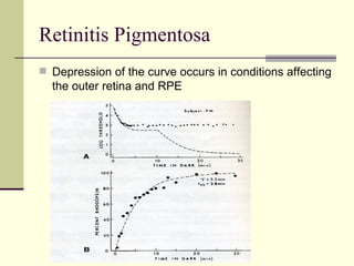 Retinitis Pigmentosa
 Depression of the curve occurs in conditions affecting
  the outer retina and RPE




                    Gauri S. Shrestha, M.Optom, FIACLE
 