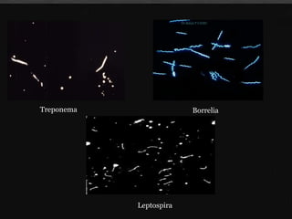 • Variants
Treponema pallidum
Borrelia
Leptospira
Treponema Borrelia
Leptospira
Dr.Balaji P CHMC
 