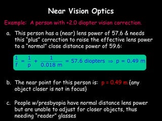 Near Vision Optics
Example: A person with +2.0 diopter vision correction.
a. This person has a (near) lens power of 57.6 & needs
   this “plus” correction to raise the effective lens power
   to a “normal” close distance power of 59.6:

    1   1      1
      =   +         = 57.6 diopters ⇒ p = 0.49 m
    f   p   0.018 m


b. The near point for this person is: p = 0.49 m {any
   object closer is not in focus}

c. People w/presbyopia have normal distance lens power
   but are unable to adjust for closer objects, thus
   needing “reader” glasses
 