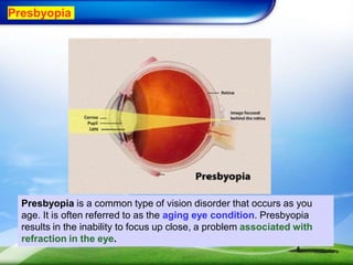 Presbyopia
Presbyopia is a common type of vision disorder that occurs as you
age. It is often referred to as the aging eye condition. Presbyopia
results in the inability to focus up close, a problem associated with
refraction in the eye.
 
