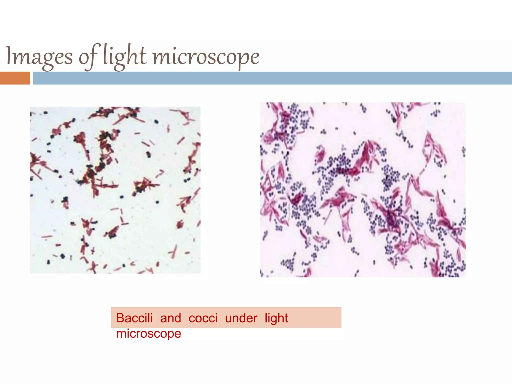 Images of light microscope
Baccili and cocci under light
microscope
 