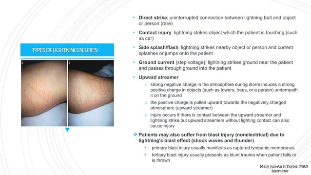 Lightning Injuries (Management and Prevention) | PPT