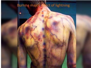 Lightning Safety Awareness by Osman Goni | PDF
