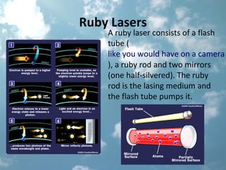 Ruby Lasing Medium Light therapy powerpoint new | PPT