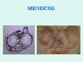 MENISCOS 