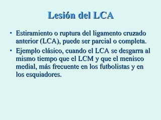 Lesión del LCA Estiramiento o ruptura del ligamento cruzado anterior (LCA), puede ser parcial o completa. Ejemplo clásico, cuando el LCA se desgarra al mismo tiempo que el LCM y que el menisco medial, más frecuente en los futbolistas y en los esquiadores.  