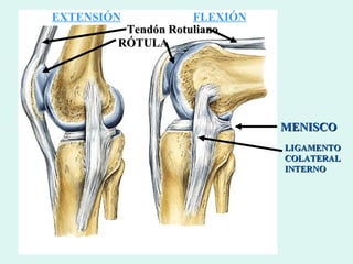 Tendón Rotuliano RÓTULA MENISCO LIGAMENTO COLATERAL INTERNO EXTENSIÓN FLEXIÓN 