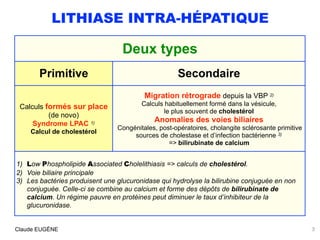 LITHIASE INTRA-HÉPATIQUE
3Claude EUGÈNE
Deux types
Primitive Secondaire
Calculs formés sur place
(de novo)
Syndrome LPAC 1...