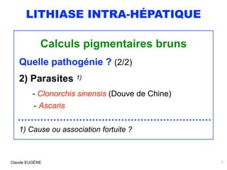 LITHIASE INTRA-HÉPATIQUE
Calculs pigmentaires bruns
Quelle pathogénie ? (2/2)
2) Parasites 1)
 
- Clonorchis sinensis (Dou...