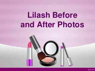 Lilash Before
and After Photos
 
