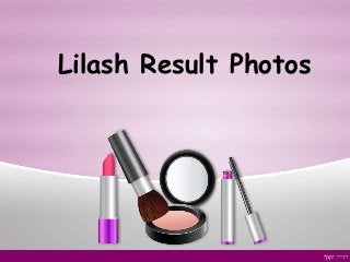 Lilash Result Photos
 